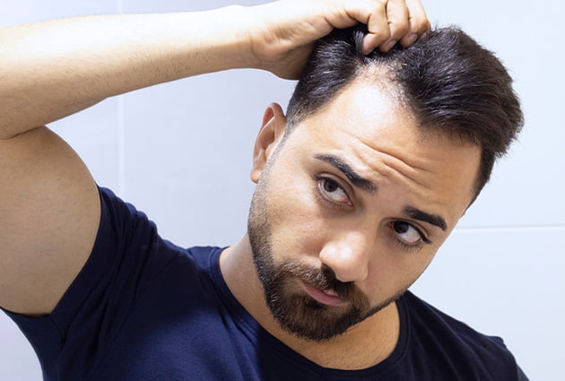 Man looking at hairline Man looking at hairline